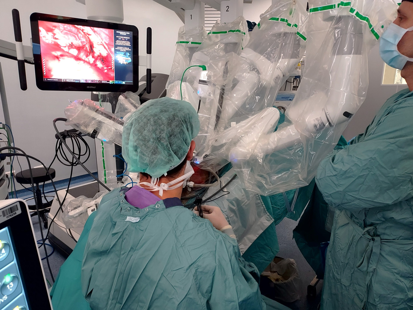 El Hospital Vall d’Hebron logra el primer trasplante entre personas con VIH.jpg